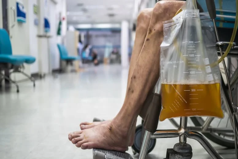 Zakażenia układu moczowego u osób starszych leczenie