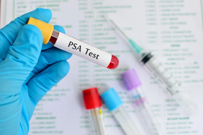 test PSA test PSA