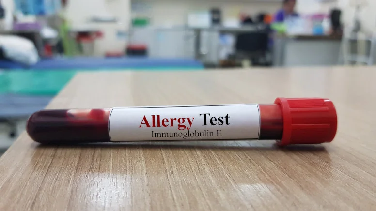 testy na alergię pokarmową testy na alergię pokarmową