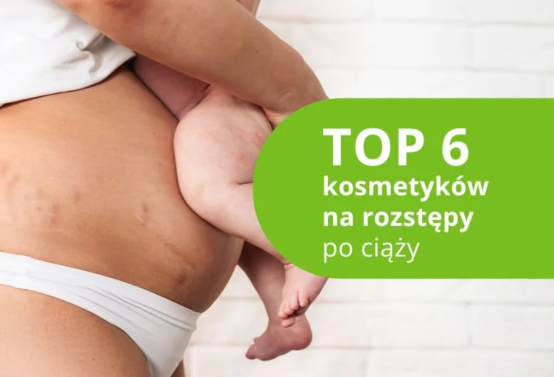 Najlepszy balsam, oliwka, krem na rozstępy po ciąży – ranking 2026