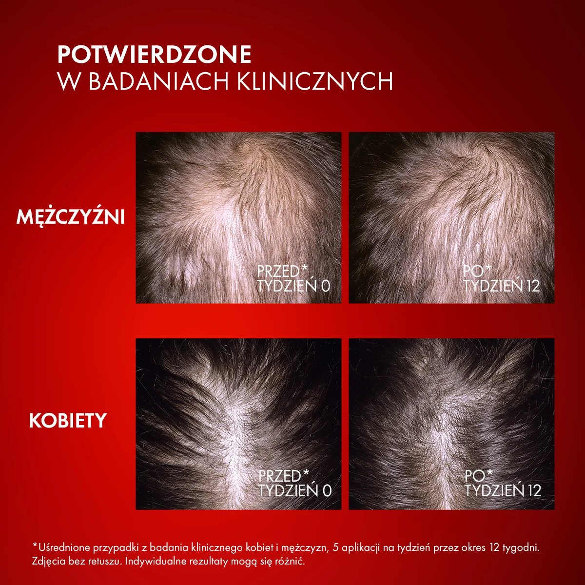 Vichy Dercos Aminexil R.E.G.E.N. Booster serum wzmacniające i stymulujące włosy, 90 ml