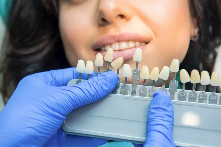 Czy wybielanie zębów jest szkodliwe? Cena za hollywoodzki uśmiech