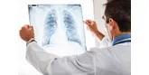 Zapalenie płuc – znasz objawy? Nie pomyl go z grypą!