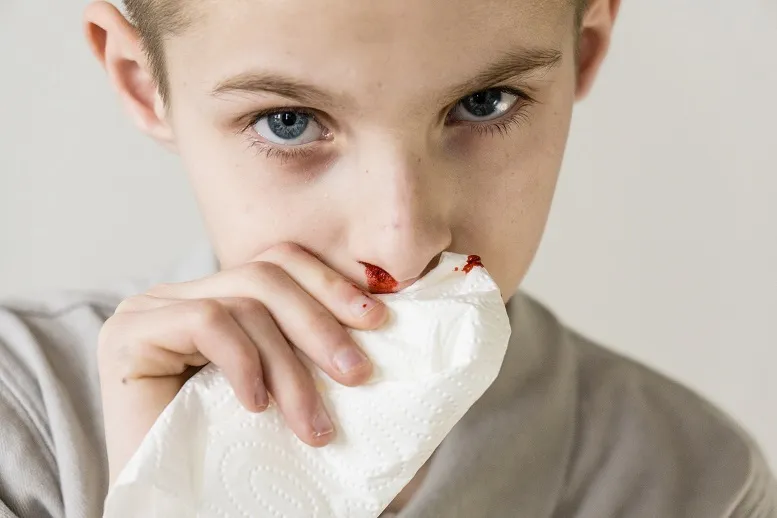 Jak zatamować krwotok z nosa – pierwsza pomoc!