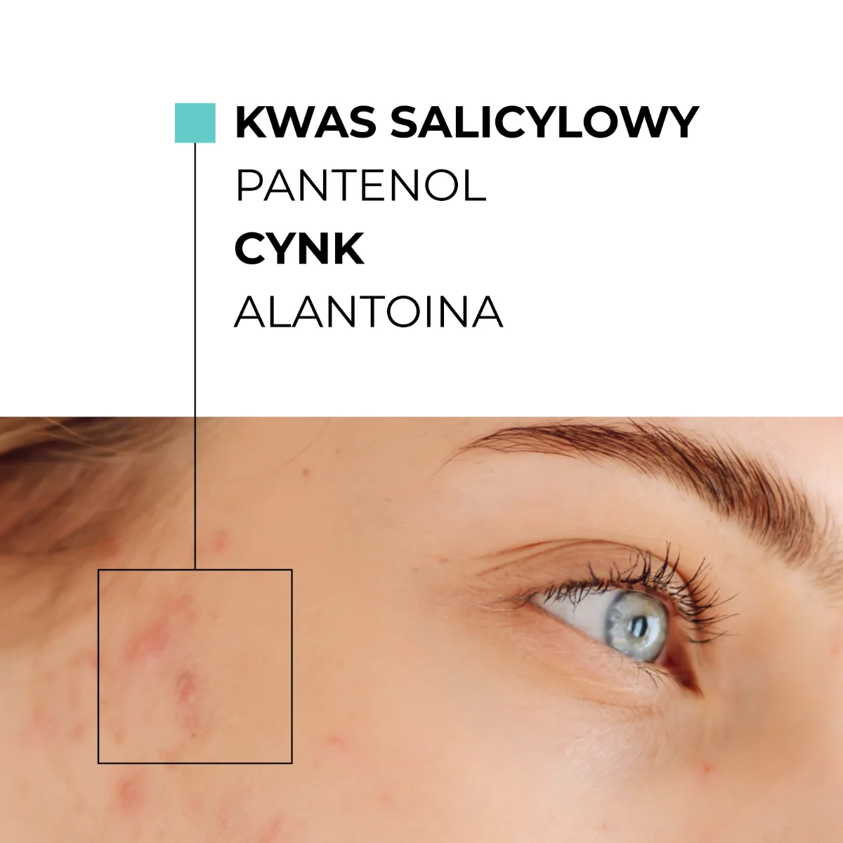 Skinexpert by Dr. Max® AcnePro Gel Cleanser Żel oczyszczający przeciw niedoskonałościom, 200 ml