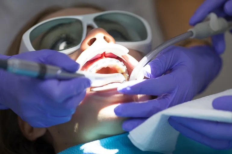 leczenie zębów laserem
