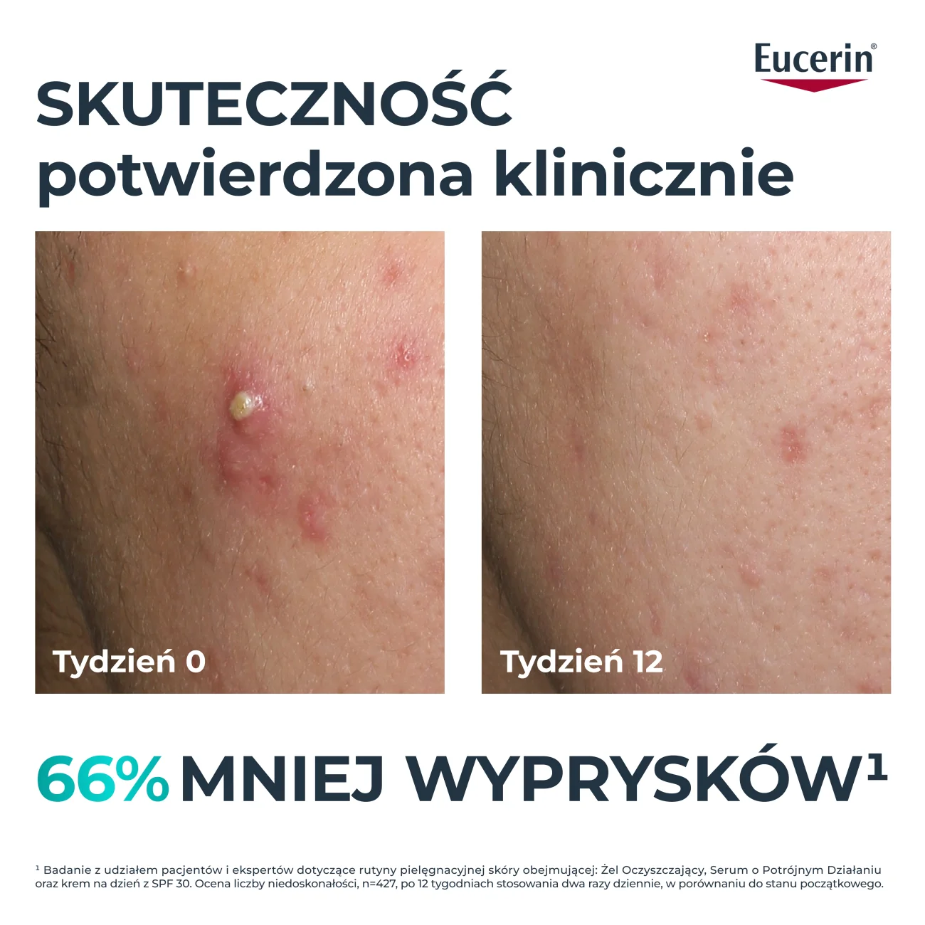 Eucerin DermoPure Clinical serum o potrójnym działaniu, 40 ml