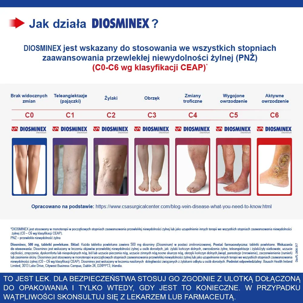 Diosminex 500 mg 60 tabletek powlekanych