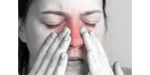 Zapalenie błony śluzowej nosa – przyczyny, objawy i leczenie
