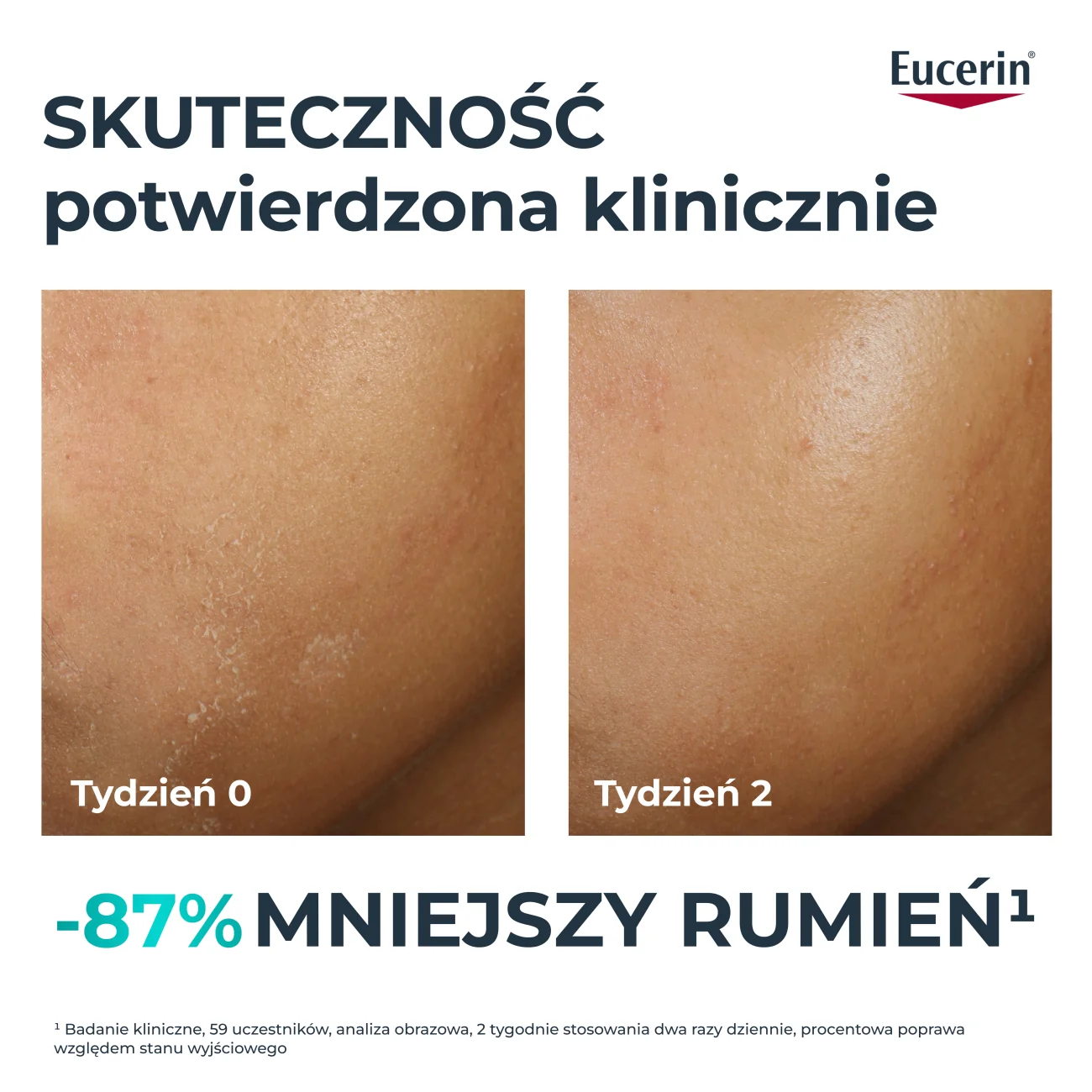 Eucerin DermoPure Clinical krem kojący hydra repair, 40 ml
