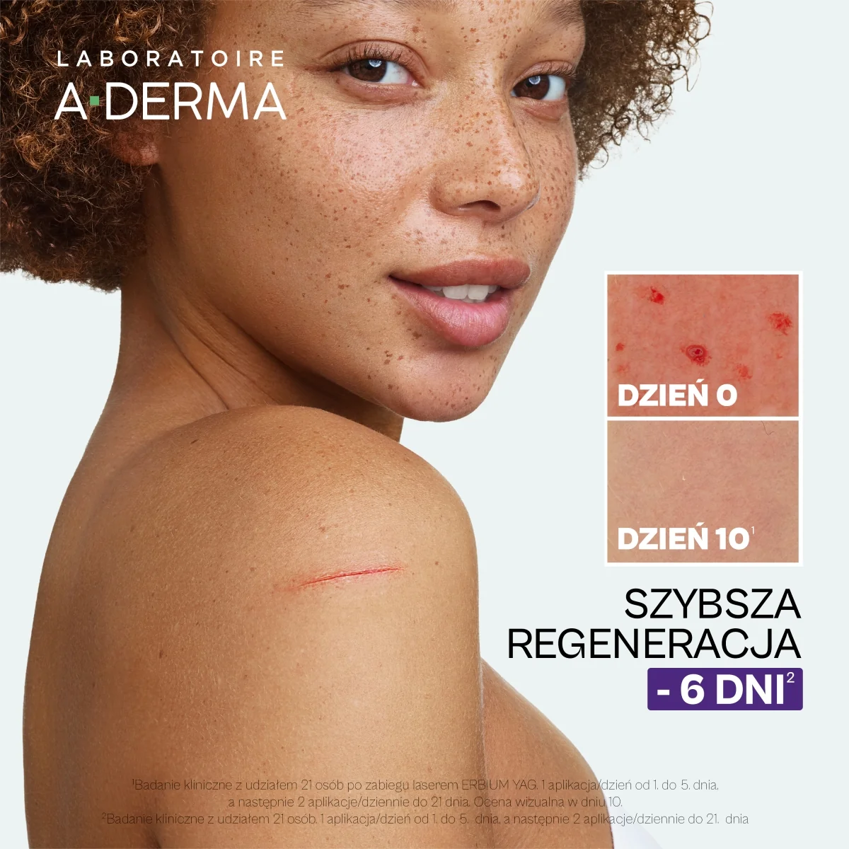 A-Derma Epitheliale Ultra Repair krem regenerujący przeciw śladom, 100 ml