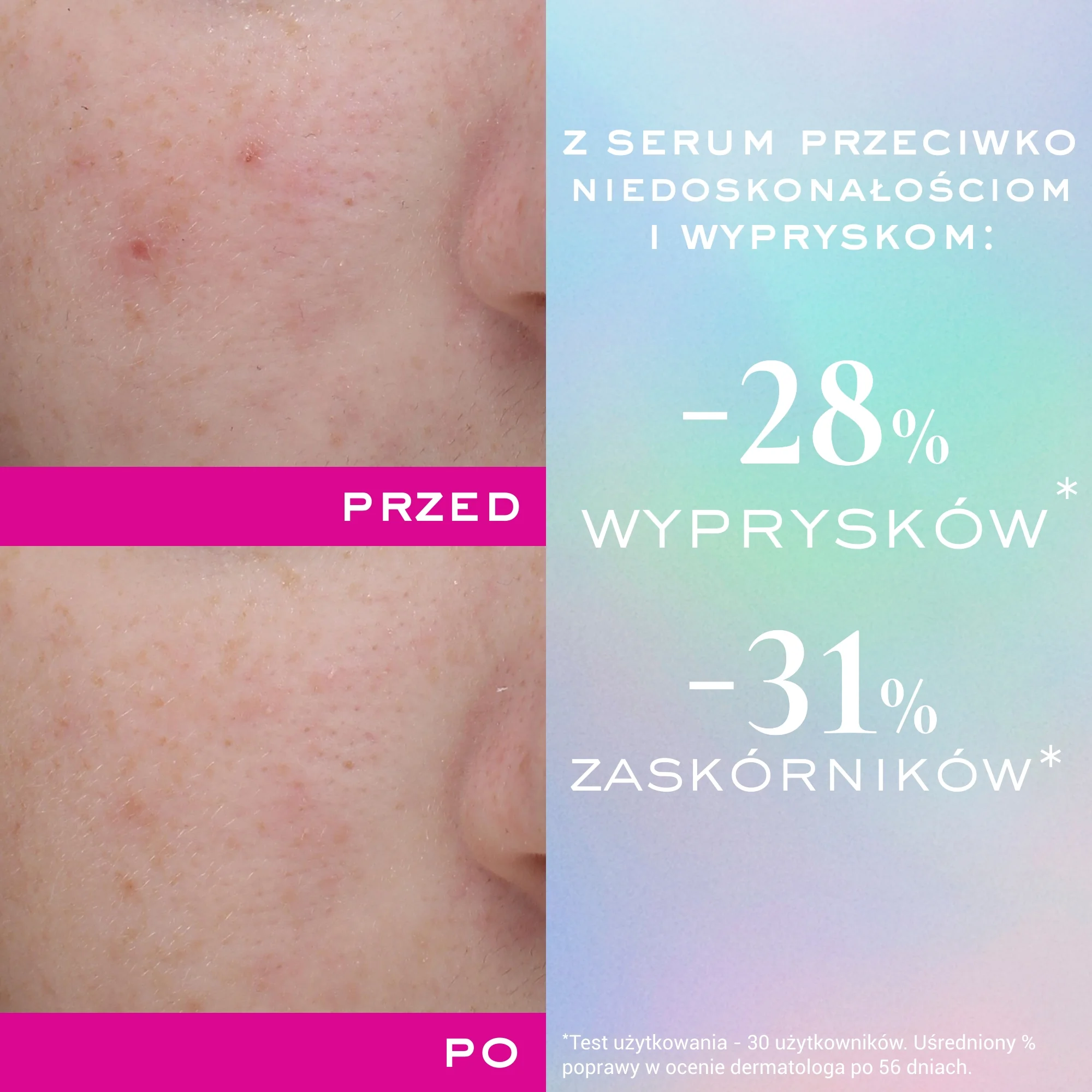 Nuxe Zinc Power serum przeciw niedoskonałościom i wypryskom, 30 ml