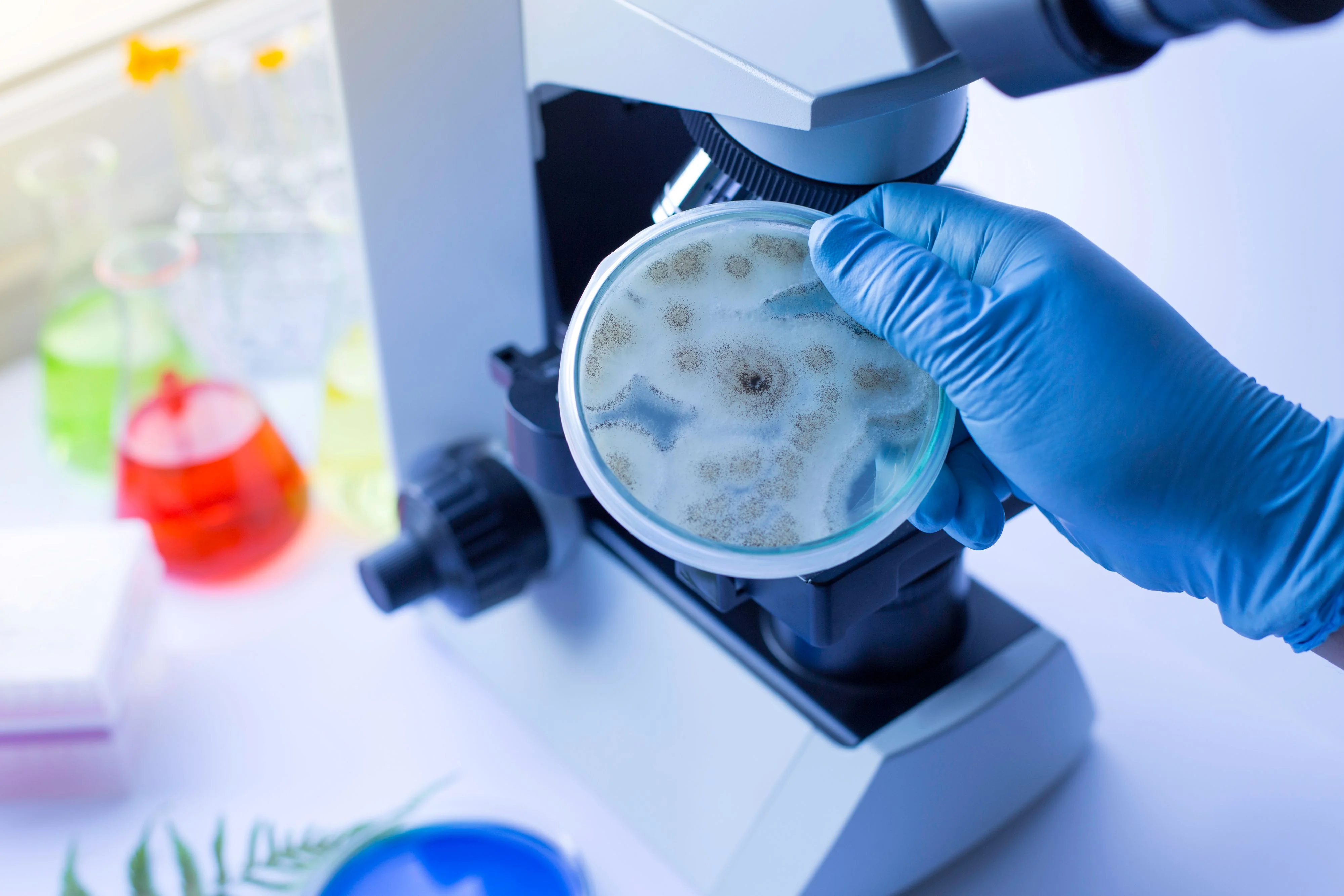 Alergia na grzyby − przyczyny Alergia na grzyby − przyczyny