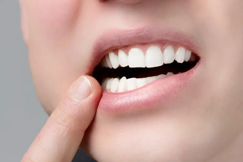 Rany w jamie ustnej – przyczyny, leczenie i domowe sposoby