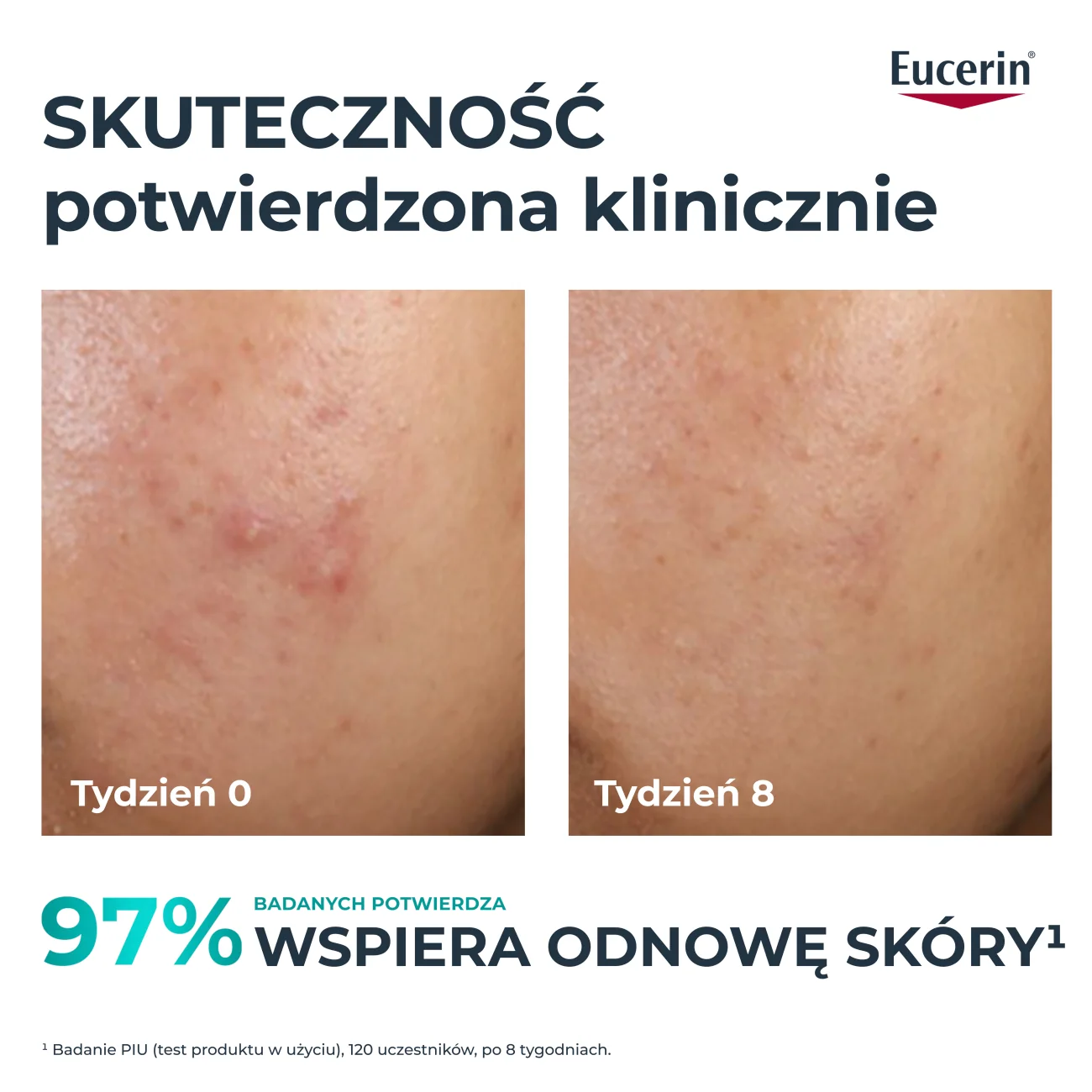 Eucerin DermoPure Clinical kuracja złuszczająco-wygładzająca, 40 ml