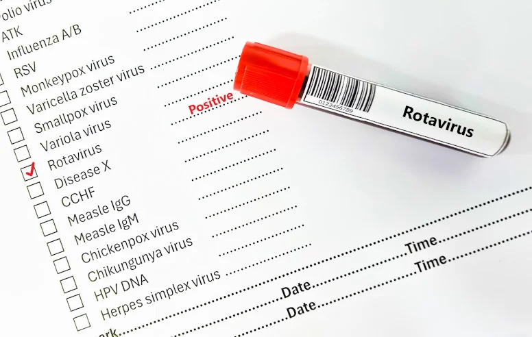 Co to jest rotawirus? Objawy zakażenia, leczenie i profilaktyka