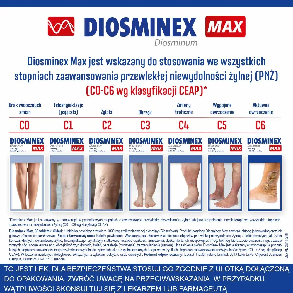 Diosminex Max 1000 mg, 60 tabletek powlekanych