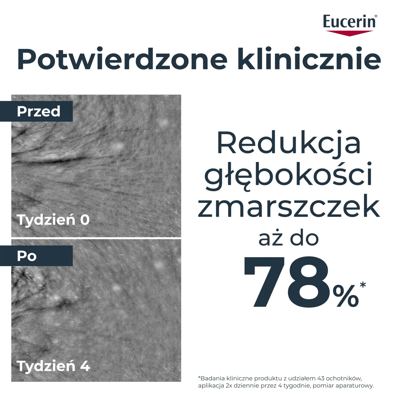 Eucerin Hyaluron-Filler serum epigenetic z epicelline, 30 ml