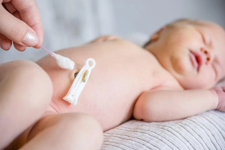 Jak dbać o pępek noworodka? Pielęgnacja pępka noworodka